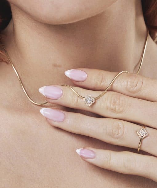 Alternative view of Anheng i gull med zirkonia